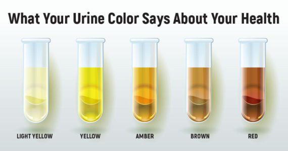 what-the-color-of-your-urine-says-about-your-health